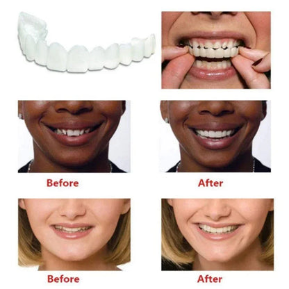 Perfect Fit Teeth Whitening Fake Tooth Cover Snap On Silicone Smile Veneers Teeth Upper Tool False Tooth Cover Oral Hygiene Care