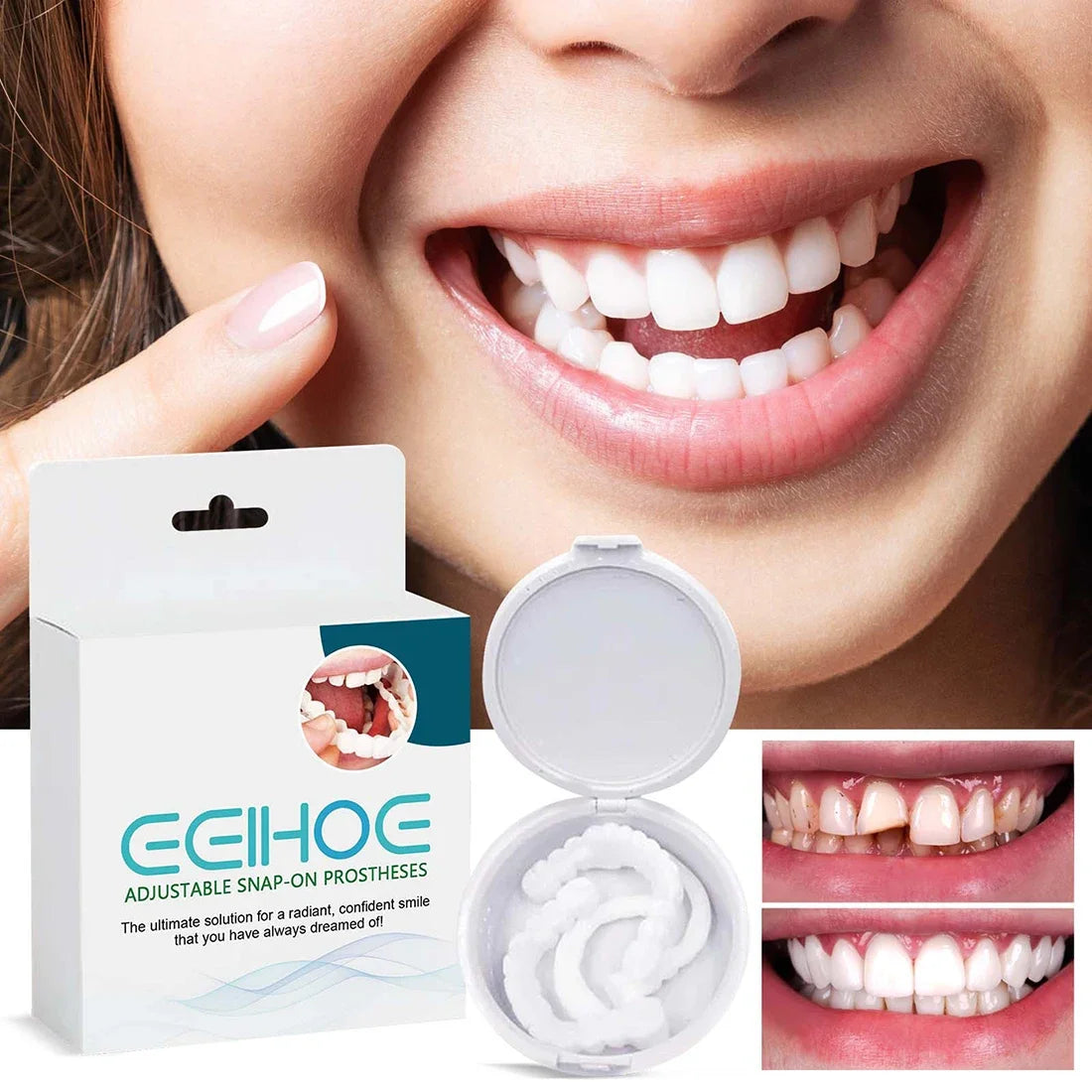 Perfect Fit Teeth Whitening Fake Tooth Cover Snap On Silicone Smile Veneers Teeth Upper Tool False Tooth Cover Oral Hygiene Care